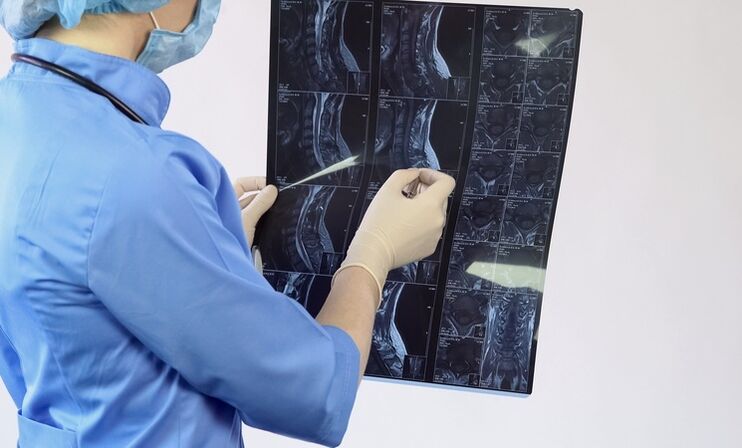 The diagnosis of cervical osteochondrosis is made on the basis of an MRI examination